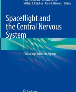 Spaceflight and the Central Nervous System (Original PDF from Publisher)