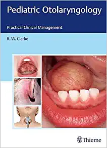 Pediatric Otolaryngology: Practical Clinical Management,1st edition (EPUB)