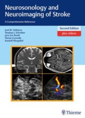 Neurosonology and Neuroimaging of Stroke: A Comprehensive Reference, 2nd Edition (PDF)