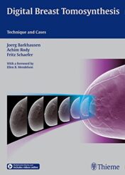 Digital Breast Tomosynthesis: Technique and Cases (ORIGINAL PDF)