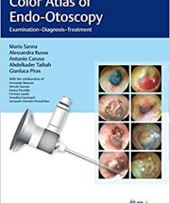Color Atlas of Endo-Otoscopy: Examination-Diagnosis-Treatment, 1st edition (EPUB)