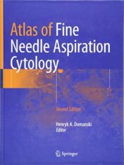 Atlas of Fine Needle Aspiration Cytology, 2nd Edition