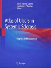 Atlas of Ulcers in Systemic Sclerosis: Diagnosis and Management