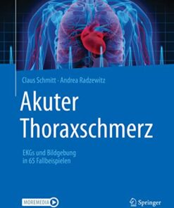 Akuter Thoraxschmerz: EKGs und Bildgebung in 65 Fallbeispielen (German Edition) (Original PDF from Publisher)