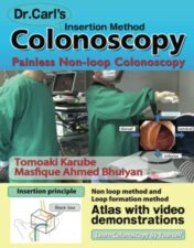 Dr. Carl’s Colonoscopy insertion method: Painless Non-loop Colonoscopy 2021 AZW 3 + EPUB + Converted PDF)
