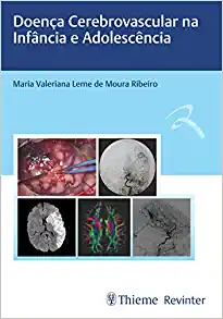Doença Cerebrovascular na Infância e Adolescência (Original PDF from Publisher)