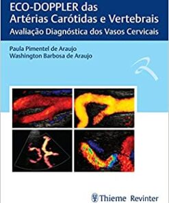 ECO-DOPPLER das Artérias Carótidas e Vertebrais: Avaliação Diagnóstica dos Vasos Cervicais (Original PDF from Publisher)