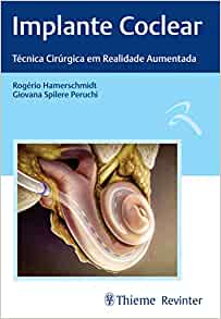 Implante Coclear: Técnicas Cirúrgica em Realidade Aumentada (Original PDF from Publisher)