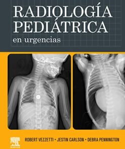 Radiología pediátrica en urgencias (Original PDF from Publisher)