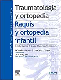 Traumatología y ortopedia. Raquis y ortopedia infantil (Original PDF from Publisher)