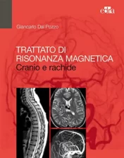 Trattato di Risonanza Magnetica: Cranio e rachide (Italian Edition) EPUB & converted pdf