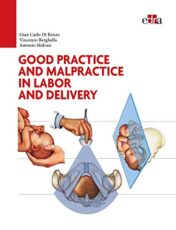 Good Practice and malpractice in labor and delivery 