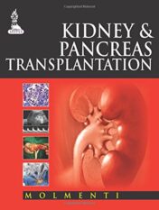 Kidney and Pancreas Transplantation (Original PDF)