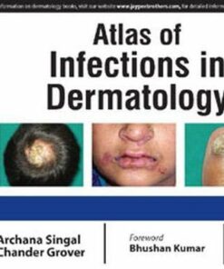 Atlas of Infections in Dermatology (Original PDF from Publisher)