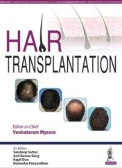 Hair Transplantation 2016 Original pdf