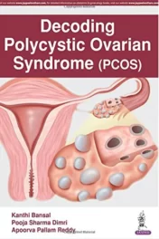 Decoding Polycystic Ovarian Syndrome (PCOS) 2017 Original PDF