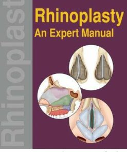 Rhinoplasty: An Expert Manual (Original PDF from Publisher)