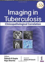 Imaging in Tuberculosis: Clinicopathological Correlation (Original PDF)