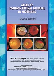 The Atlas of Retinal Diseases in Nigerians (Original PDF)