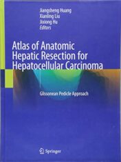 Atlas of Anatomic Hepatic Resection for Hepatocellular Carcinoma: Glissonean Pedicle Approach