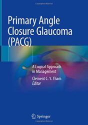 Primary Angle Closure Glaucoma (PACG): A Logical Approach in Management (Original PDF)