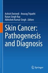 Skin Cancer: Pathogenesis and Diagnosis Original PDF 2021