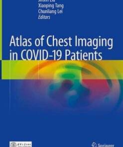 Atlas of Chest Imaging in COVID-19 Patients (Original PDF from Publisher)