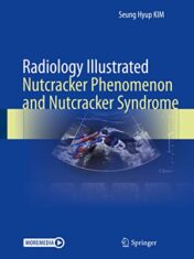 Radiology Illustrated: Nutcracker Phenomenon and Nutcracker Syndrome 2022 Original PDF+videos