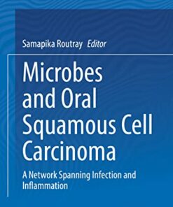 Microbes and Oral Squamous Cell Carcinoma: A Network Spanning Infection and Inflammation (Original PDF from Publisher)