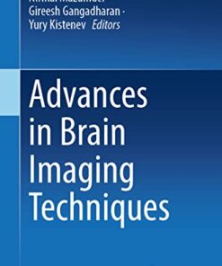 Advances in Brain Imaging Techniques (Original PDF from Publisher)