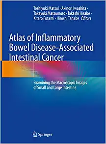 Atlas of Inflammatory Bowel Disease-Associated Intestinal Cancer: Examining the Macroscopic Images of Small and Large Intestine (Original PDF from Publisher)