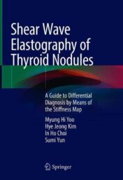 Shear Wave Elastography of Thyroid Nodules: A Guide to Differential Diagnosis by Means of the Stiffness Map (Original PDF)