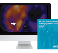 A Practical and Current Approach for Managing Incidental Findings