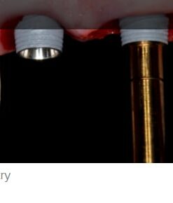 gIDE A to Z in Implant Dentistry