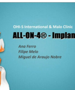 ALL-ON-4 – Implant Prosthetics
