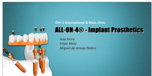 ALL-ON-4 – Implant Prosthetics
