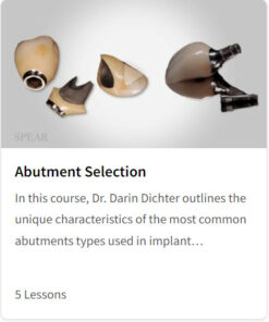 Abutment Selection
