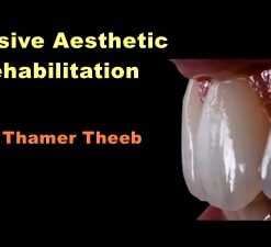 Video Dental Adhesive Aesthetic Rehabilitation
