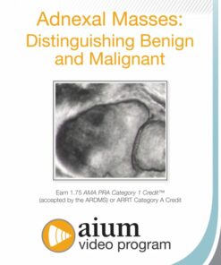 Adnexal Masses: Distinguishing Benign and Malignant