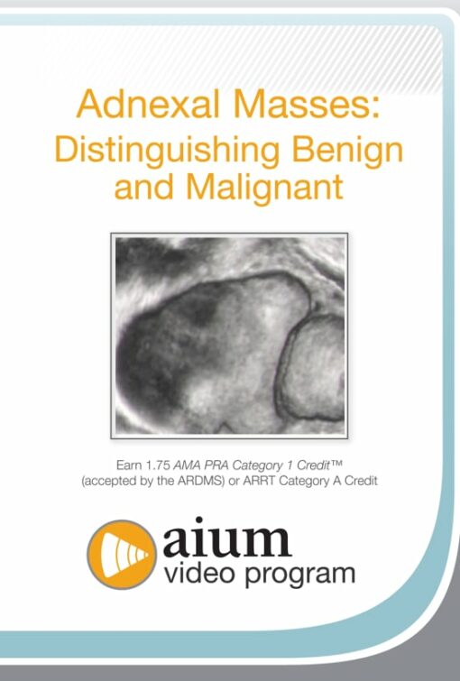 Adnexal Masses: Distinguishing Benign and Malignant