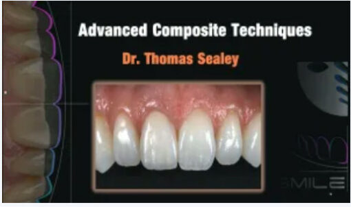Advanced Composite Techniques (Video Course)