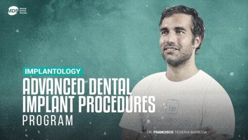 Advanced Dental Implant Procedures -Dr Francisco Teixeria Barbosa-
