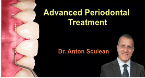 Advanced Periodontal Treatment (Video Course)
