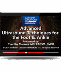 Advanced Ultrasound Techniques for the Foot and Ankle