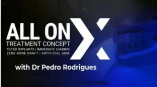 All On X Treatment Concept (Video Course)