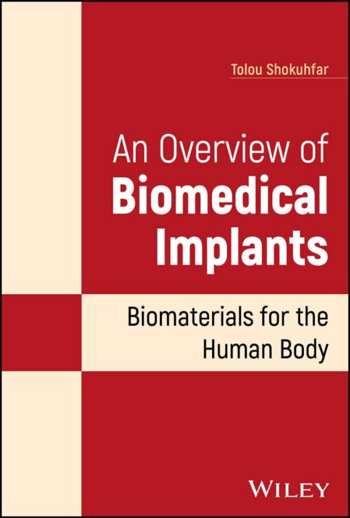 An Overview of Biomedical Implants: Biomaterials for the Human Body 1st Edition PDF