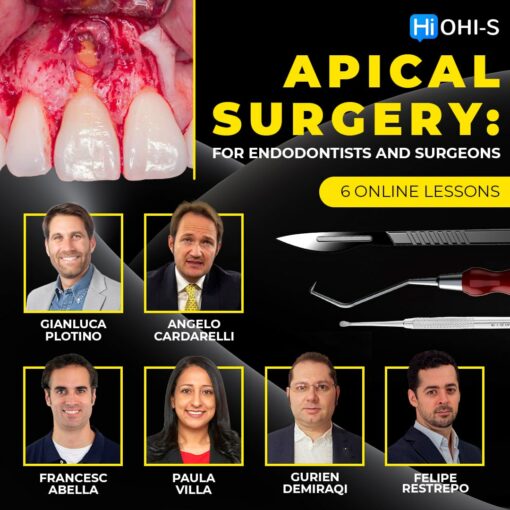 Apical surgery: for endodontists and surgeons