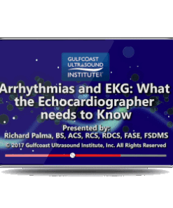 Arrhythmias and EKG: What the Echocardiographer Needs to Know