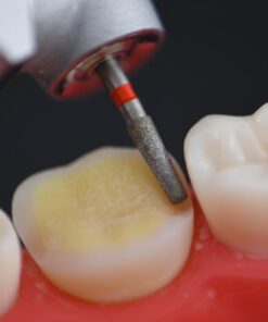 BAARD Overlay & Onlay Preparation Design Course