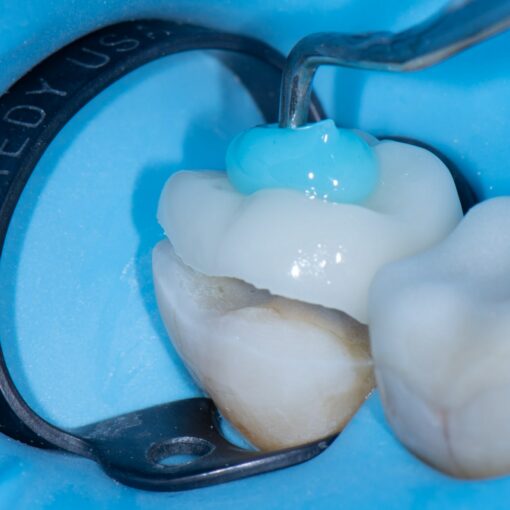 BAARD Posterior Rubber Dam Isolation Course